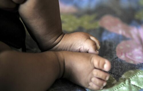 Câncer mais comum na infância, leucemia deve ter mais de 11 mil casos no Brasil até 2025 Câncer mais comum na infância, leucemia deve ter mais de 11 mil casos no Brasil até 2025