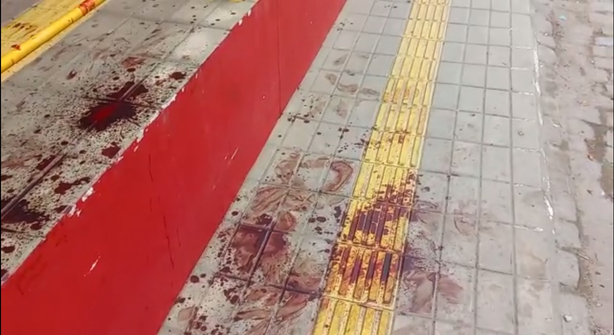 Através do BJM Polícia Civil abre investigação para descobrir quem espancou o morador de rua Através do BJM Polícia Civil abre investigação para descobrir quem espancou o morador de rua