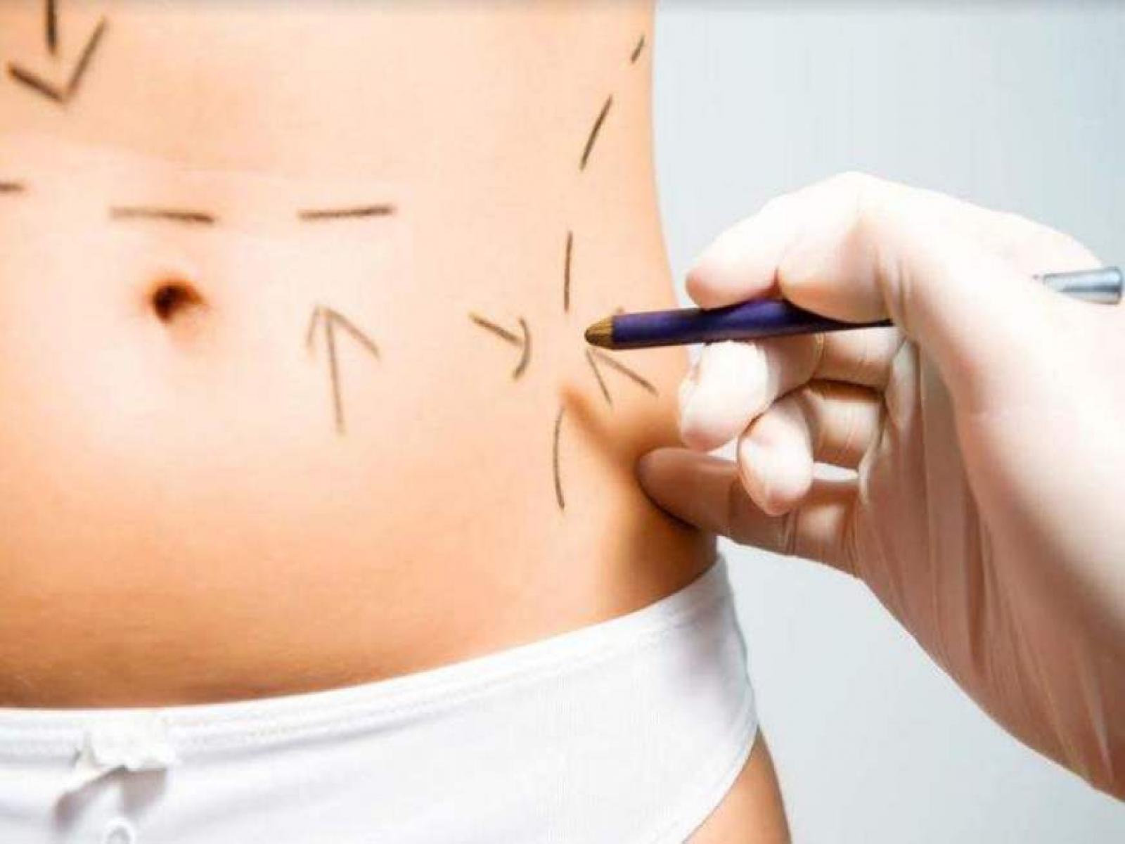 O motivo que as mulheres procuram por cirurgia plástica é o mesmo dos homens?