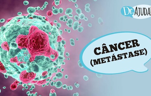 Metástase do Câncer: o que é, diagnóstico e tratamento Metástase do Câncer: o que é, diagnóstico e tratamento