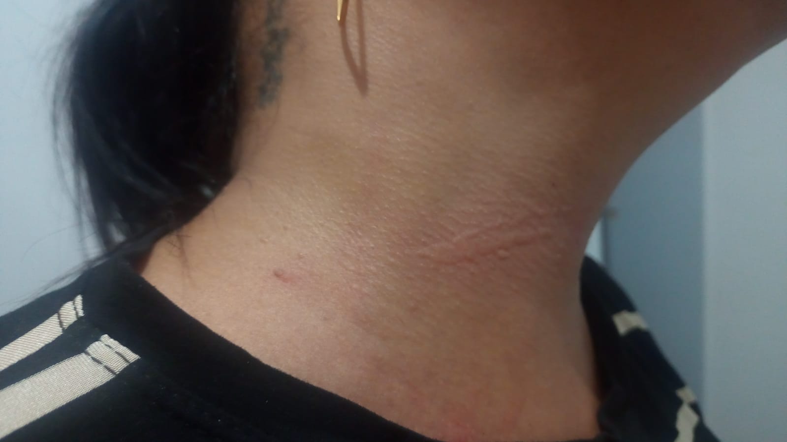 Jequié: Motociclista fica ferida ao ter o pescoço atingido por uma linha de pipa com cerol Jequié: Motociclista fica ferida ao ter o pescoço atingido por uma linha de pipa com cerol