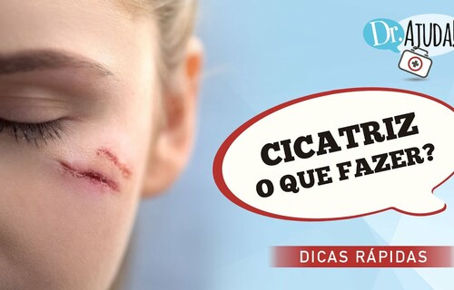 Cicatrizes: como cuidar? Cicatrizes: como cuidar?