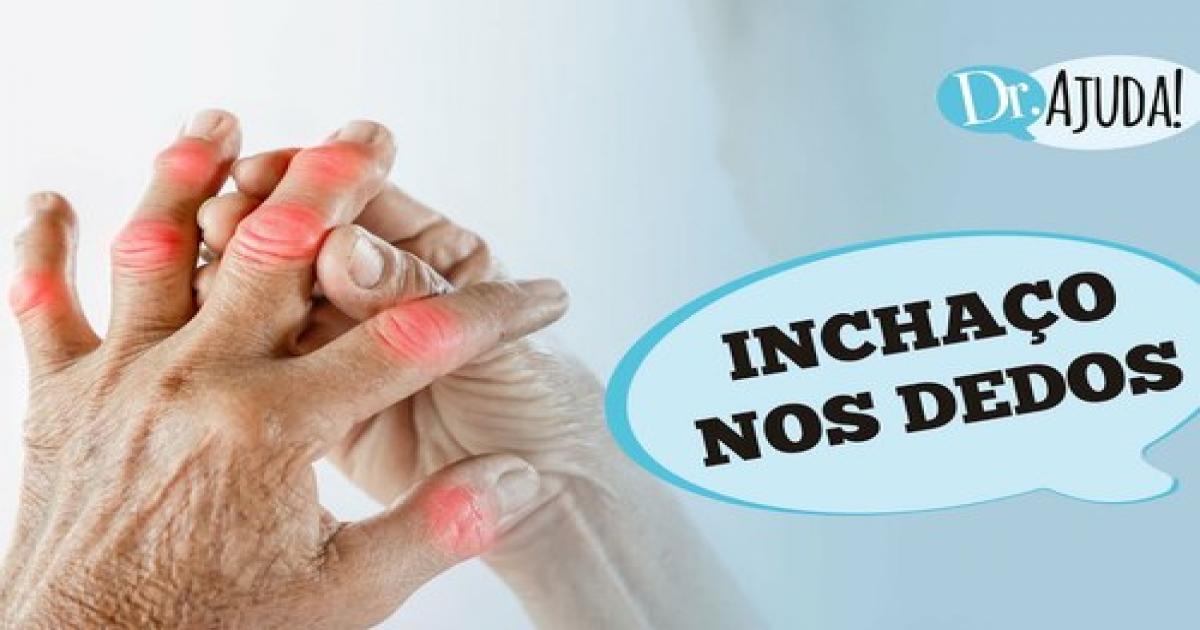 Inchaço nos dedos: o que pode ser e como tratar?