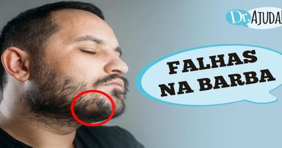 Quais as causas de falhas na barba?