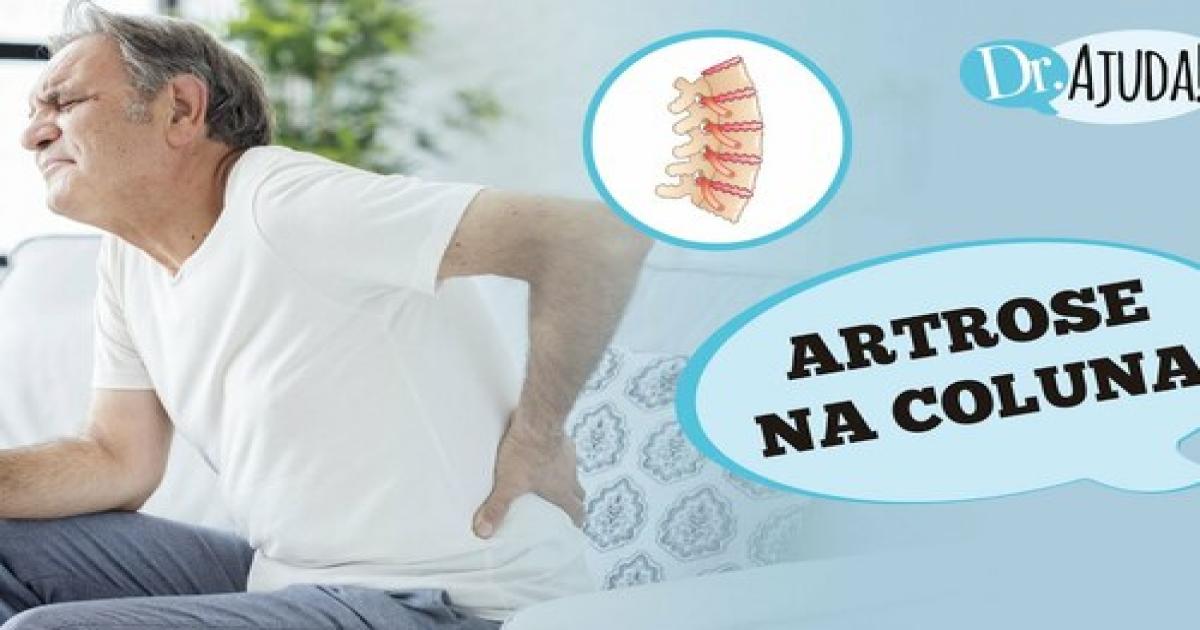 O que é artrose na coluna? Quando suspeitar e qual o tratamento?