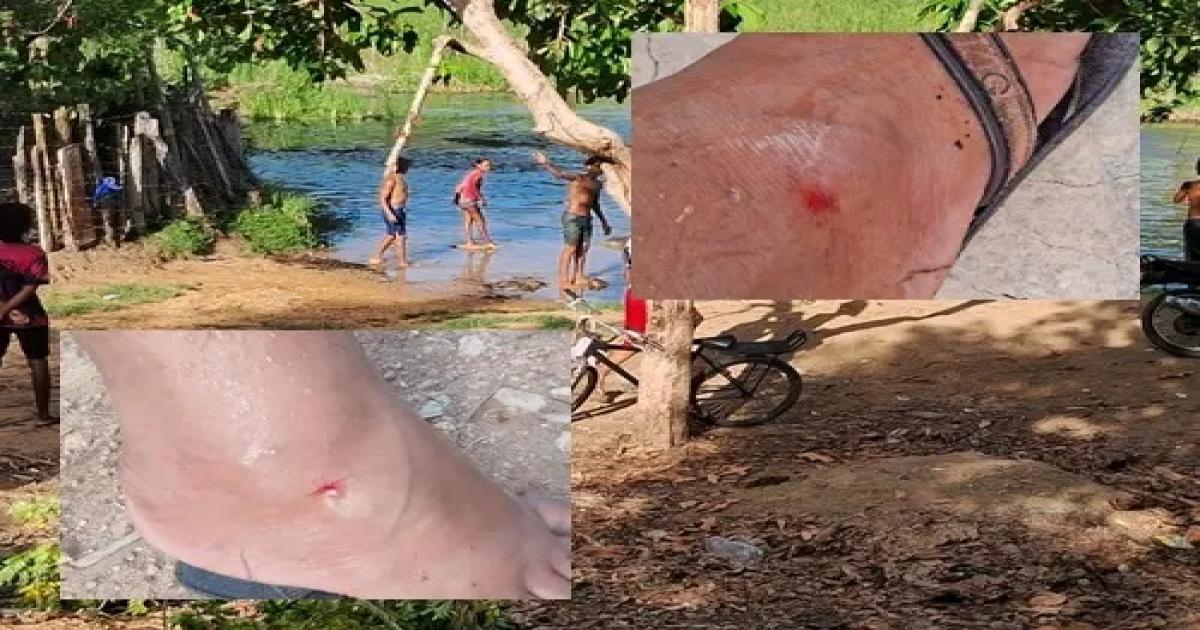 Jitaúna: Quatro banhistas ficam feridos em ataque de piranhas no rio que corta a cidade