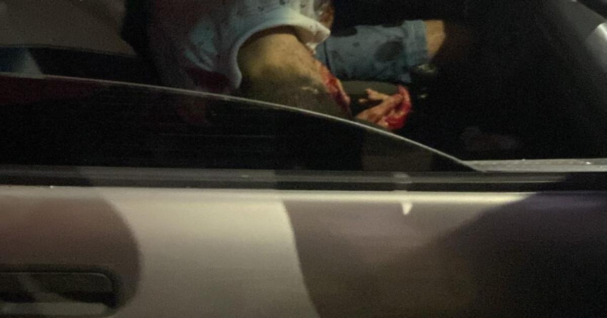 QUATRO MORTES VIOLENTAS EM TRÊS DIAS AUMENTAM PREOCUPAÇÕES EM SANTA LUZIA