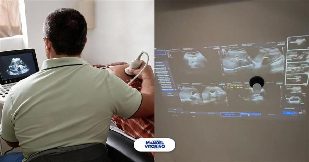 Com tecnologia inédita, Prefeitura de Manoel Vitorino oferece exame de ultrassom obstétrico 4D para gestantes