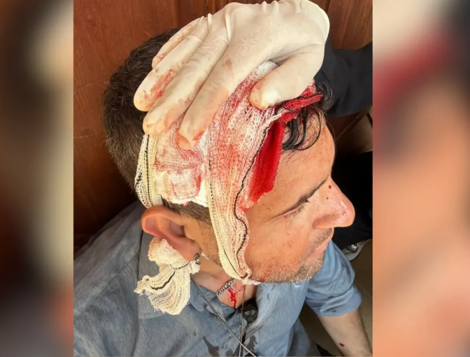 Segurança do GSI de Lula é agredido por indígenas em evento petista