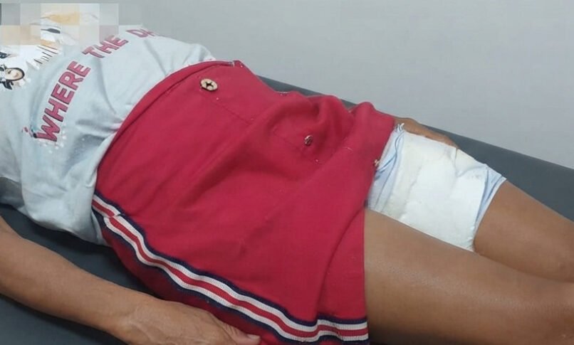 Apuarema: Mulher é transferida para o Prado Valadares após ser atacada por cachorro Apuarema: Mulher é transferida para o Prado Valadares após ser atacada por cachorro