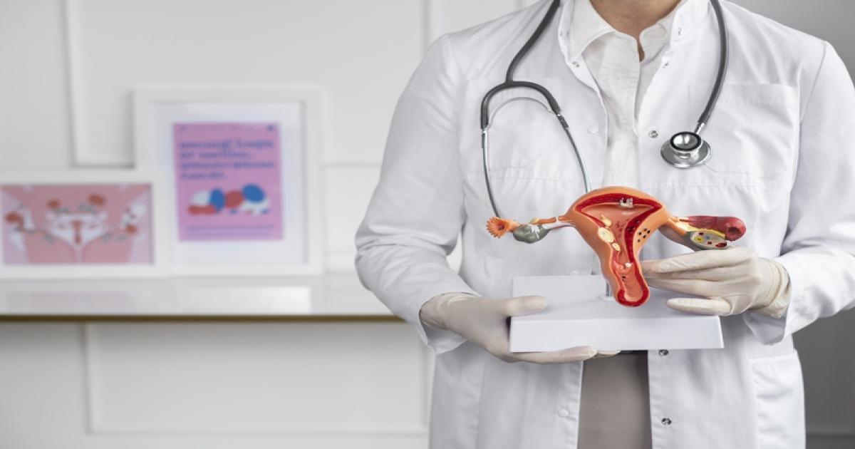 Dia da Luta contra a Endometriose: atenção básica é aliada no diagnóstico precoce e no cuidado contínuo