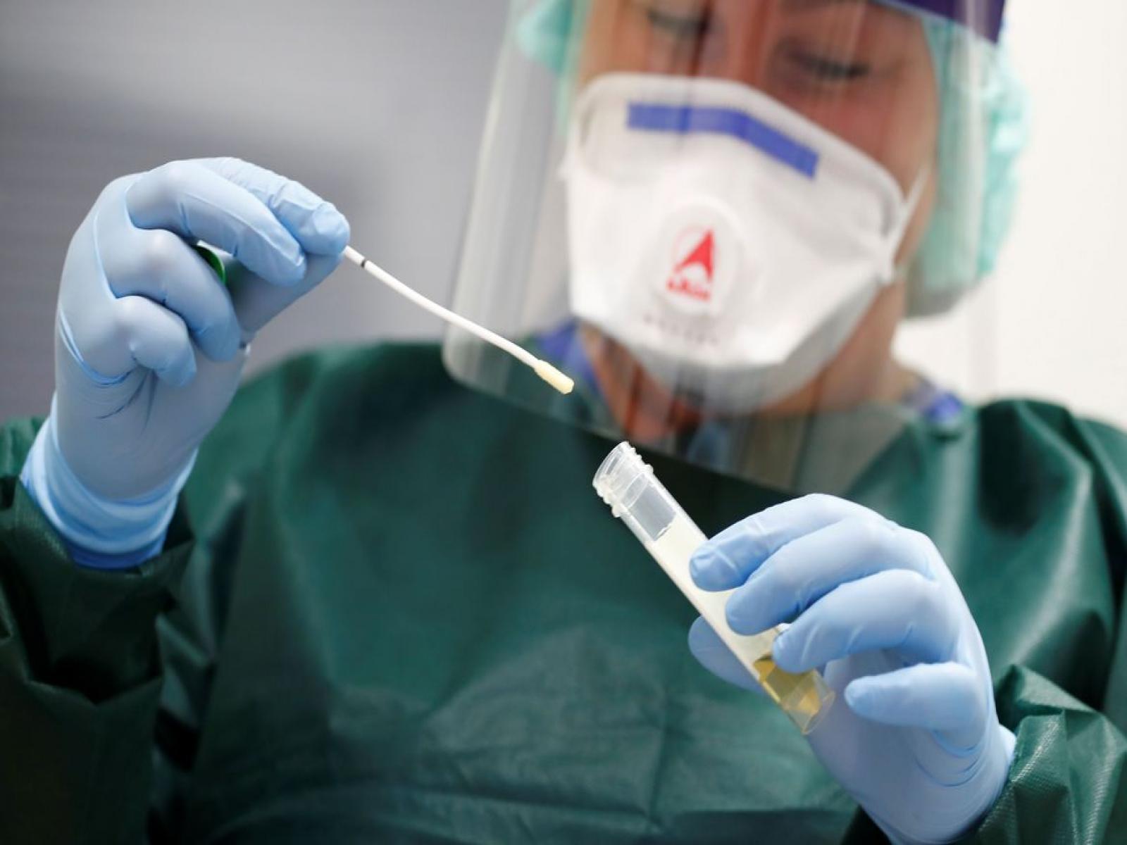 Planos de saúde são obrigados a cobrir testes de detecção da Covid-19