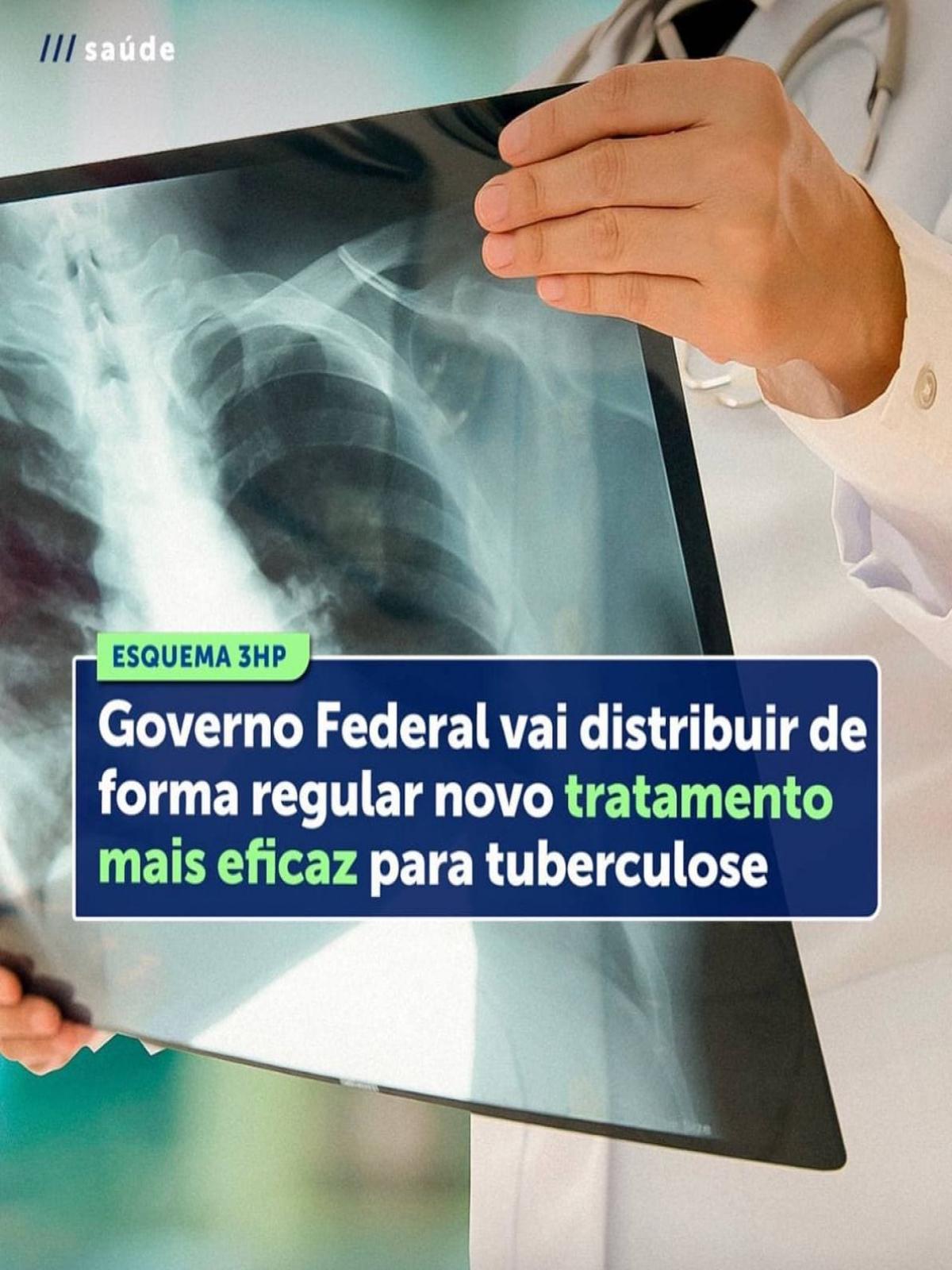 Governo Federal vai distribuir novo tratamento contra tuberculose