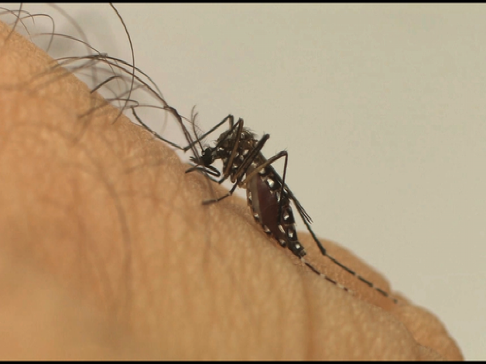 Papo de mosquito: dor de cabeça