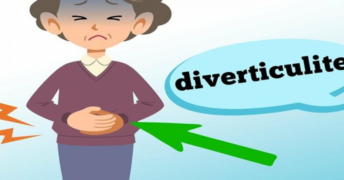 O que é diverticulite? Quando devo suspeitar?
