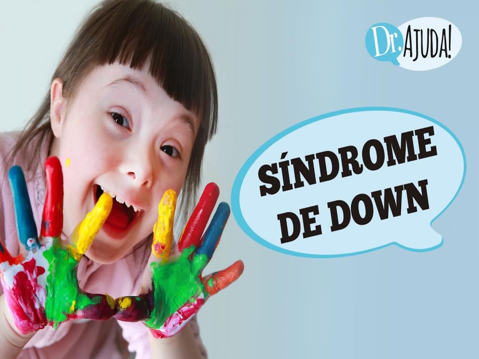 SÍNDROME DE DOWN: genética, riscos e características